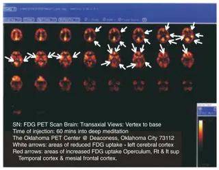 Conclusion of the Research on HDH