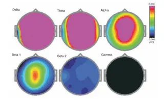 Research on HDH EEG Brainstate Patterns-Deep Samadhi Condition