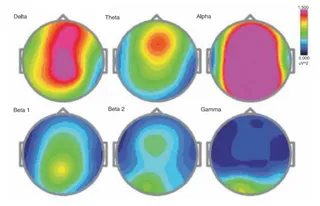 Research on HDH EEG Brainstate Patterns-Baseline Eyes Open Condition
