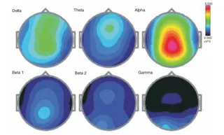 Research on HDH EEG Brainstate Patterns-Baseline Eyes Open Condition