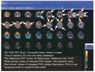 Conclusion of the Research on HDH