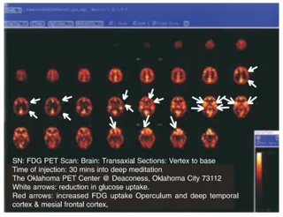 Conclusion of the Research on HDH