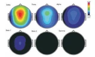 Research on HDH EEG Brainstate Patterns-Deep Samadhi Condition