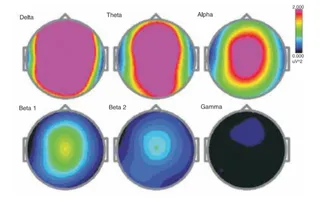 Research on HDH EEG Baseline Meditation Condition