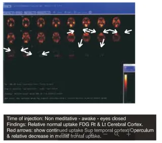 Conclusion of the Research on HDH