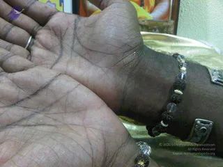 2011 -eNMiracles Collections